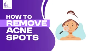 How To Remove Acne Spots